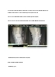물리치료 SOAP 조00님 무릎수술 Lt Collateral ligament Rupture   (2 )